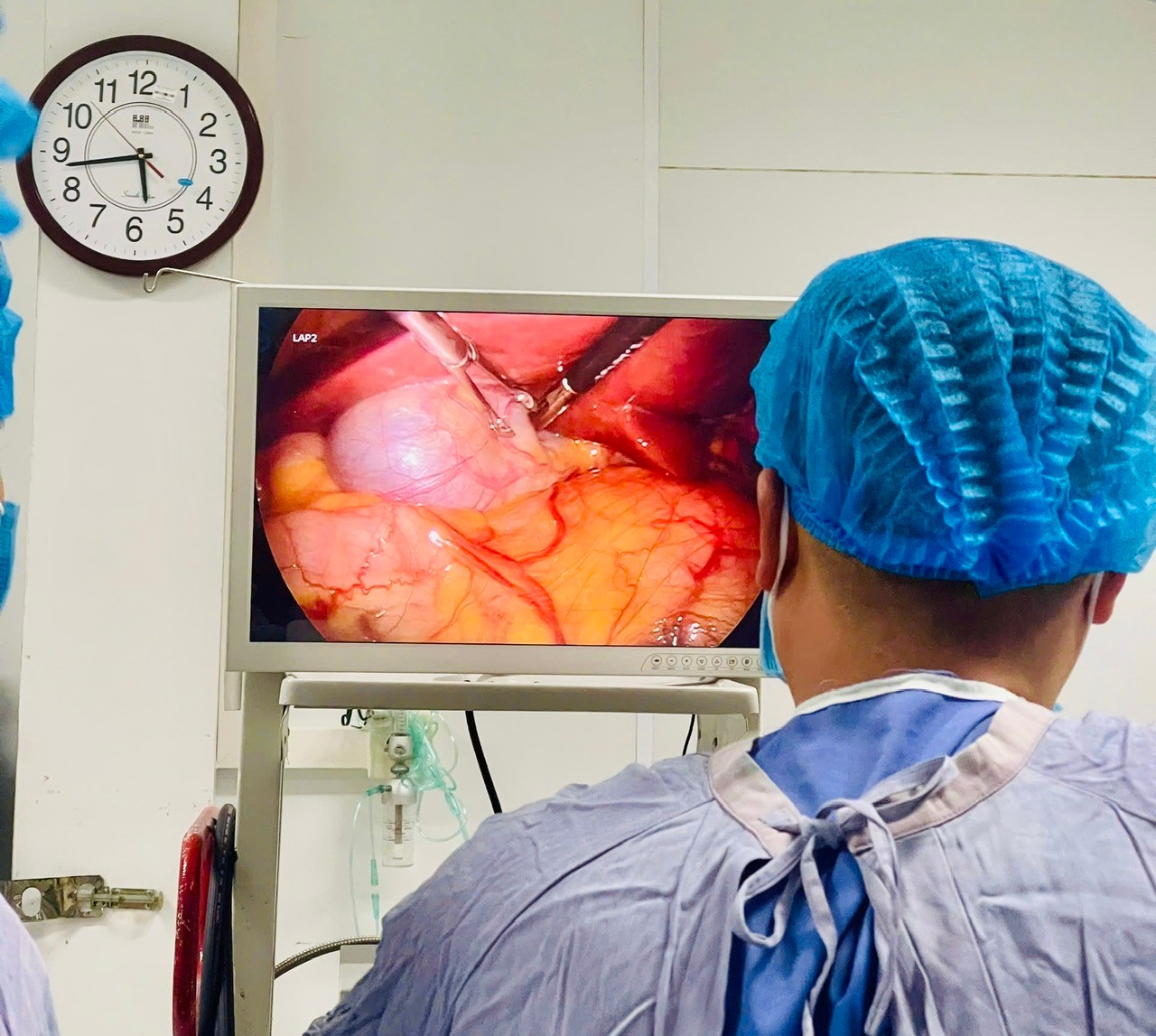 BỆNH VIỆN ĐA KHOA HÒA BÌNH CHUYỂN GIAO KỸ THUẬT MỔ NỘI SOI CẮT TÚI MẬT CHO TRUNG TÂM Y TẾ KHU VỰC TÂN LẠC